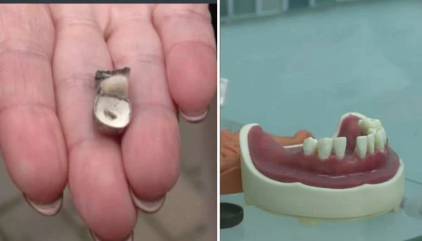 Изображение к статье: «Порнография» во рту! Пациентка шокирована услугой стоматолога