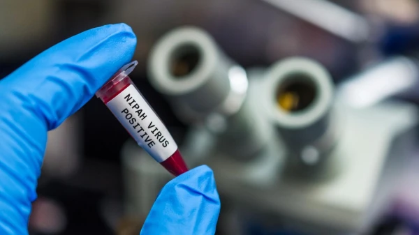 Тесты в аэропортах и карантинные меры: почему вирус Нипах вызывает тревогу