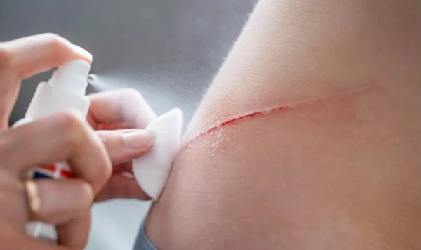 Изображение к статье: Революционное средство от царапин.