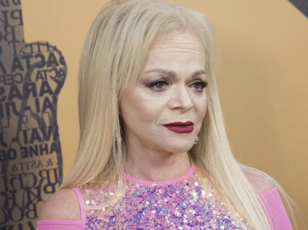 «Сколько можно издеваться?» Директор Ларисы Долиной призвал прекратить травлю певицы