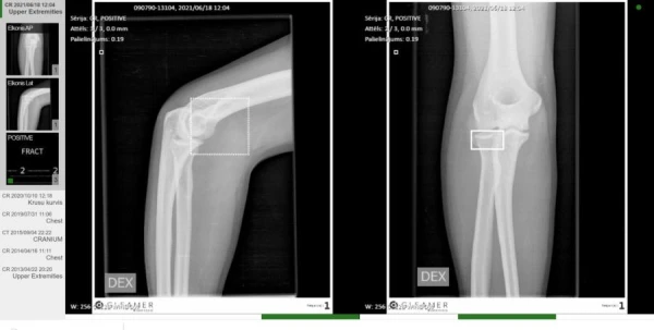 Искусственный интеллект «добрался» до сосудов человека