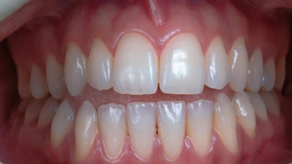 Изображение к статье: Раскрыта неожиданная причина повышенного риска потери зубов