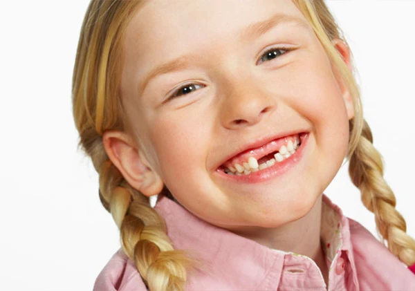 Изображение к статье: Нужно ли лечить молочные зубы или можно ждать, пока они выпадут