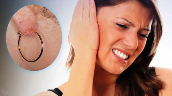 Изображение к статье: Почему чешутся и краснеют уши от сережек: вся правда об аллергии на бижутерию