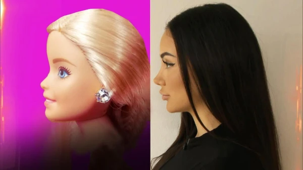 Изображение к статье: «Нос как у Барби» выходит из моды: пластические хирурги говорят о возвращении естественности