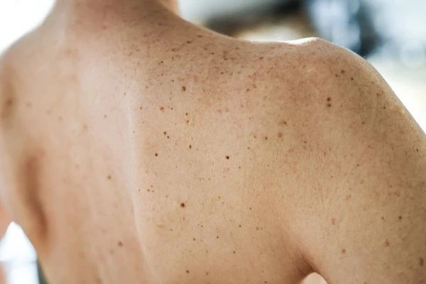 Изображение к статье: Ученый назвал неочевидный симптом рака