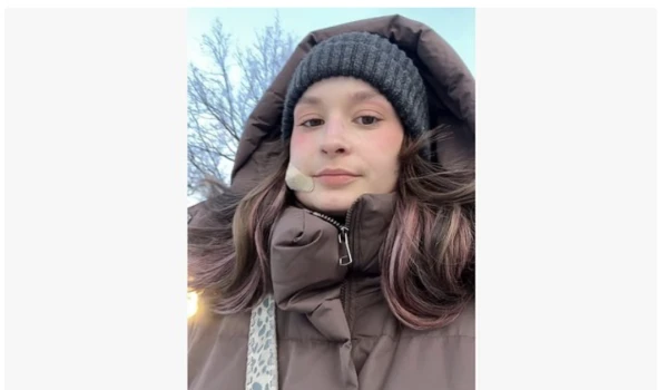 Изображение к статье: Блогерша выдавила прыщ на лице и едва не лишилась жизни