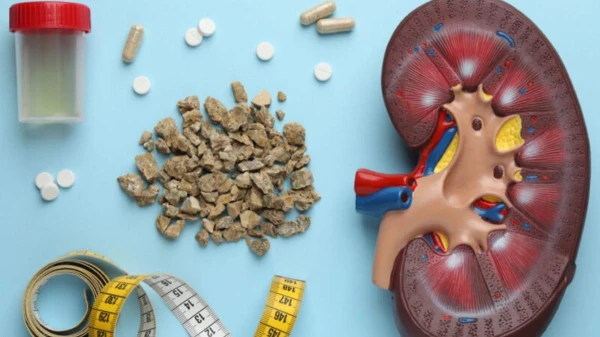 Изображение к статье: Камни в почках: врачи назвали продукты-провокаторы и продукты-защитники