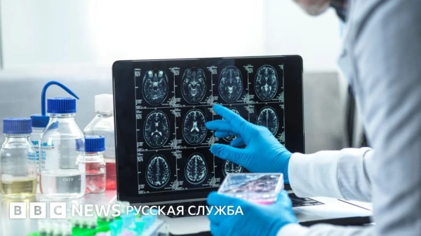 Громкое разочарование: новые лекарства от Альцгеймера оказались бессильны?